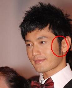 明星种植头发图片,揭秘明星秀发重生之路