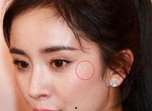 明星划伤伤疤,揭秘明星背后的划痕故事